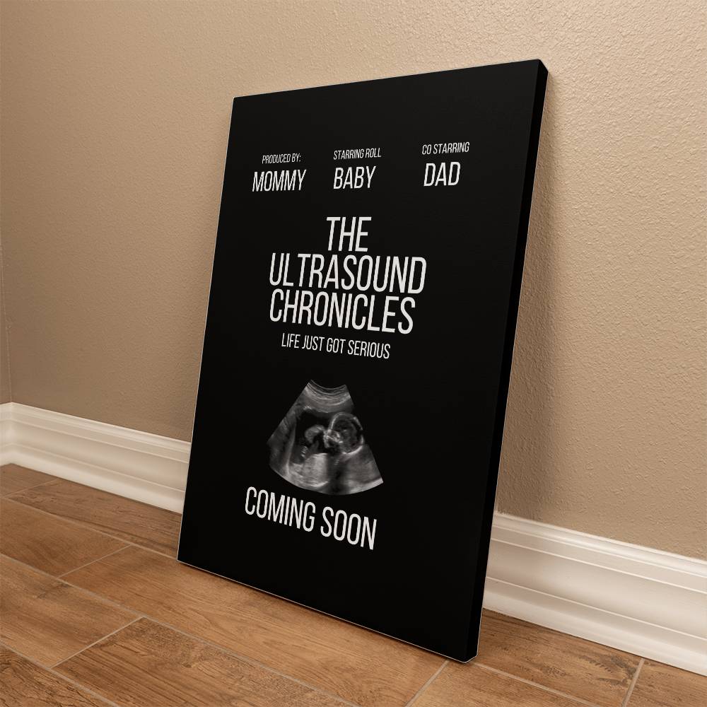 A Gallery Wrapped Canvas (2:3) titled "The Ultrasound Chronicles" featuring an ultrasound image designed as wall art, with text indicating a starring role for "baby" and the tagline "life just got serious".